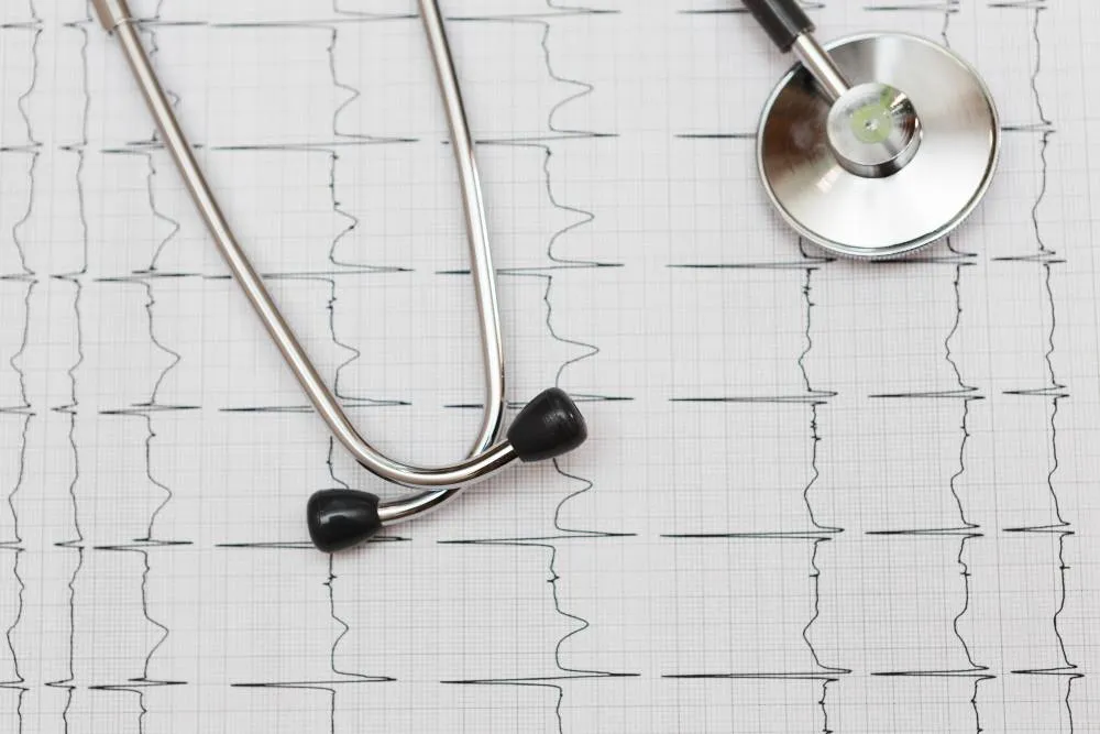 Electrocardiograma